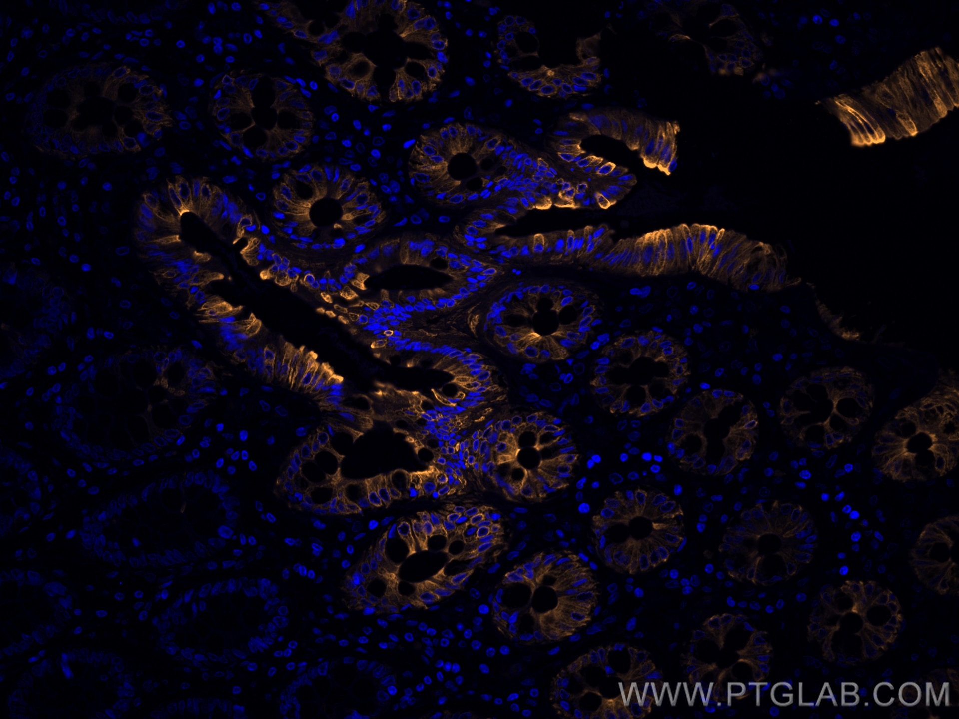 Immunofluorescence (IF) / fluorescent staining of human colon tissue using CoraLite®555-conjugated Cytokeratin 20 Monoclonal  (CL555-60183)