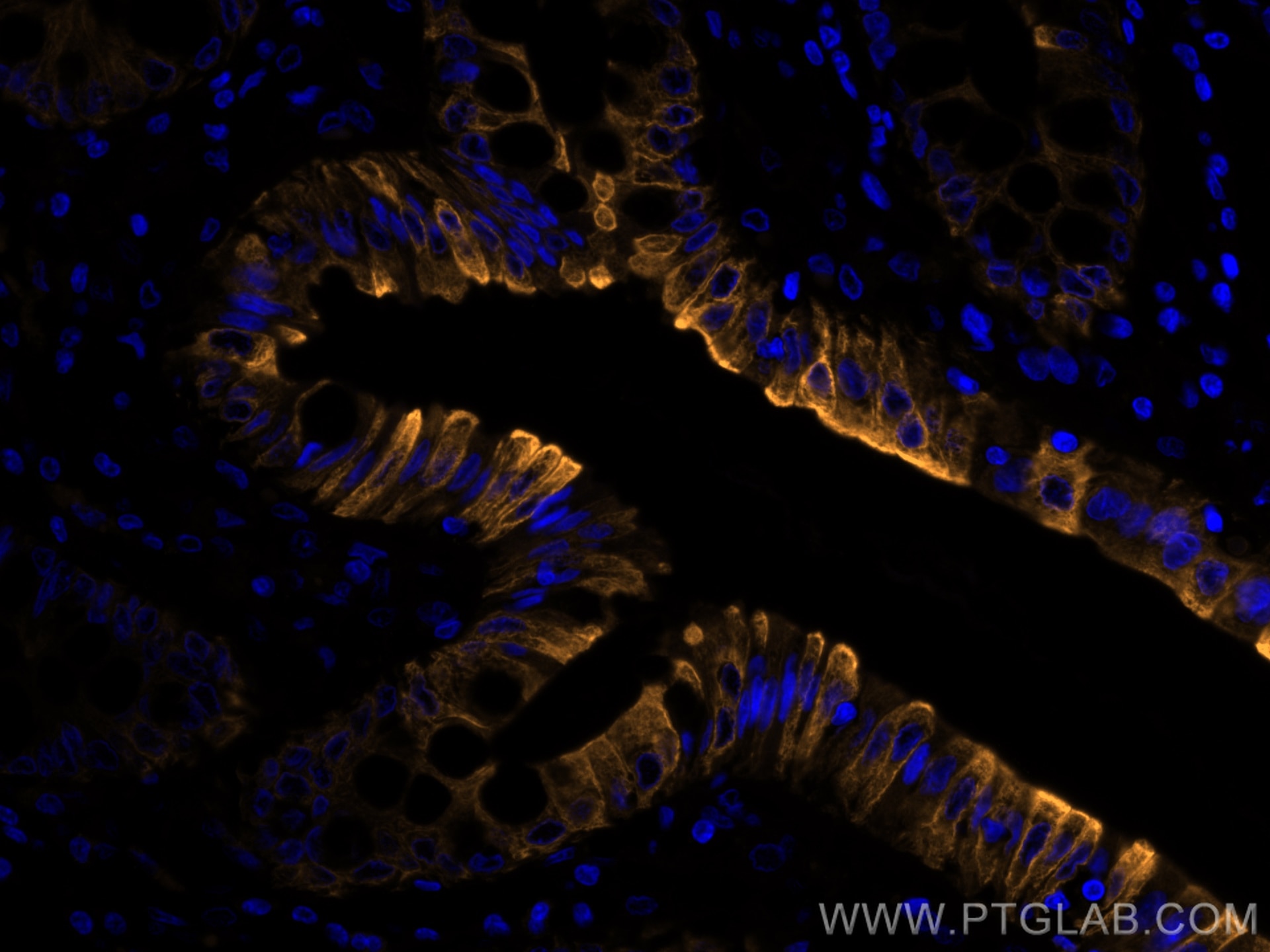 Immunofluorescence (IF) / fluorescent staining of human colon tissue using CoraLite®555-conjugated Cytokeratin 20 Monoclonal  (CL555-60183)