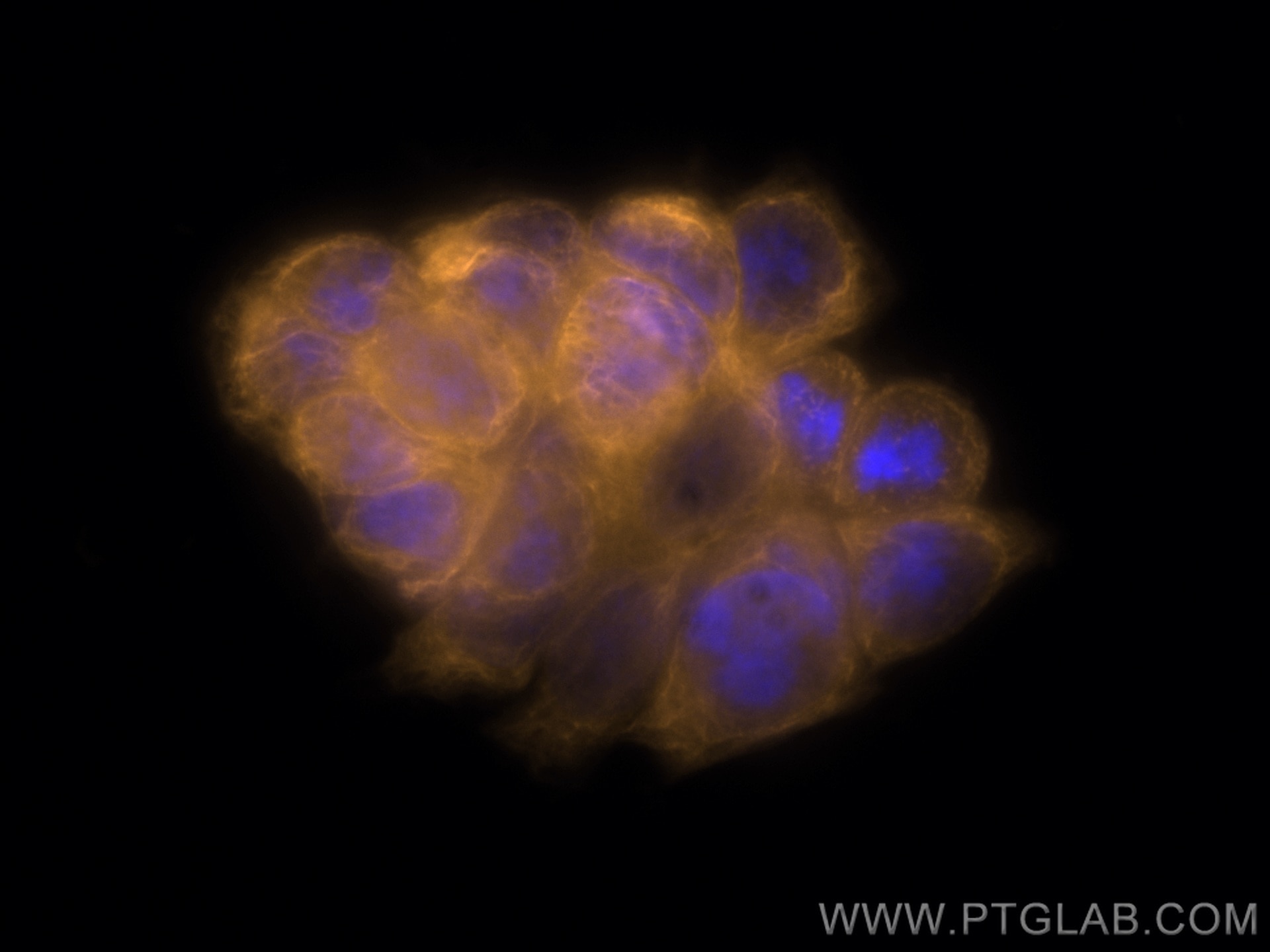 Immunofluorescence (IF) / fluorescent staining of HT-29 cells using CoraLite®555-conjugated Cytokeratin 20 Monoclonal  (CL555-60183)