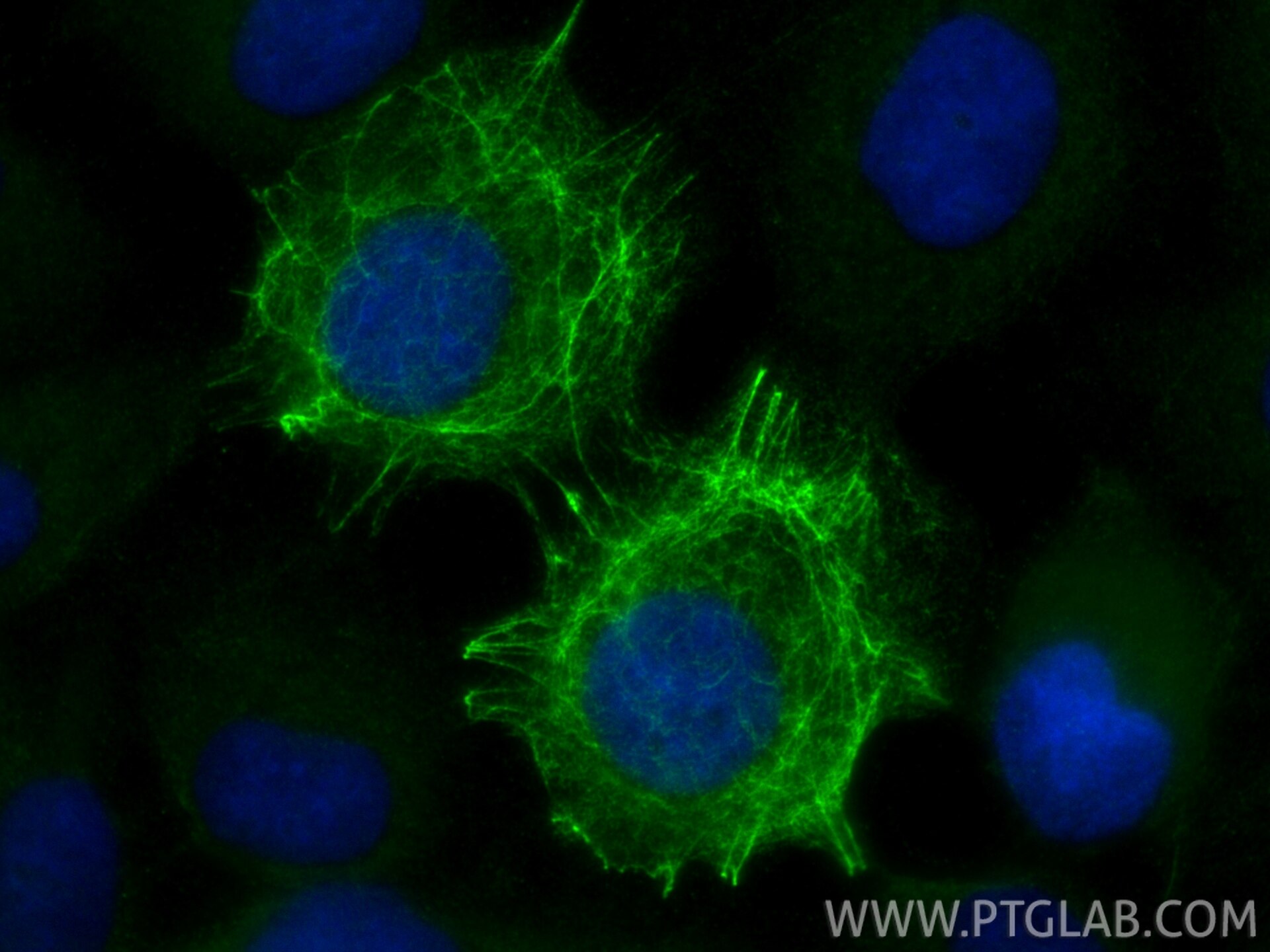 Immunofluorescence (IF) / fluorescent staining of A431 cells using Cytokeratin 24 Polyclonal antibody (33702-1-AP)