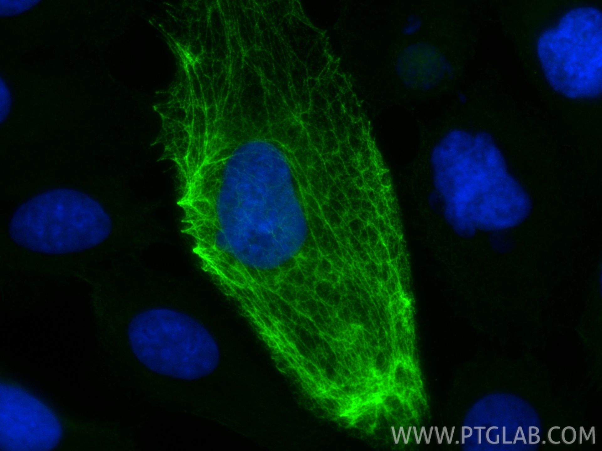 Immunofluorescence (IF) / fluorescent staining of A431 cells using Cytokeratin 24 Polyclonal antibody (33702-1-AP)