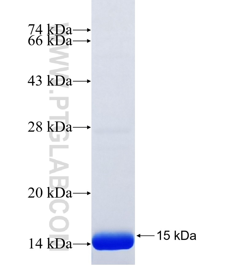 KRT24 fusion protein Ag40490 SDS-PAGE KRT24 fusion protein Ag40490 SDS-PAGE
