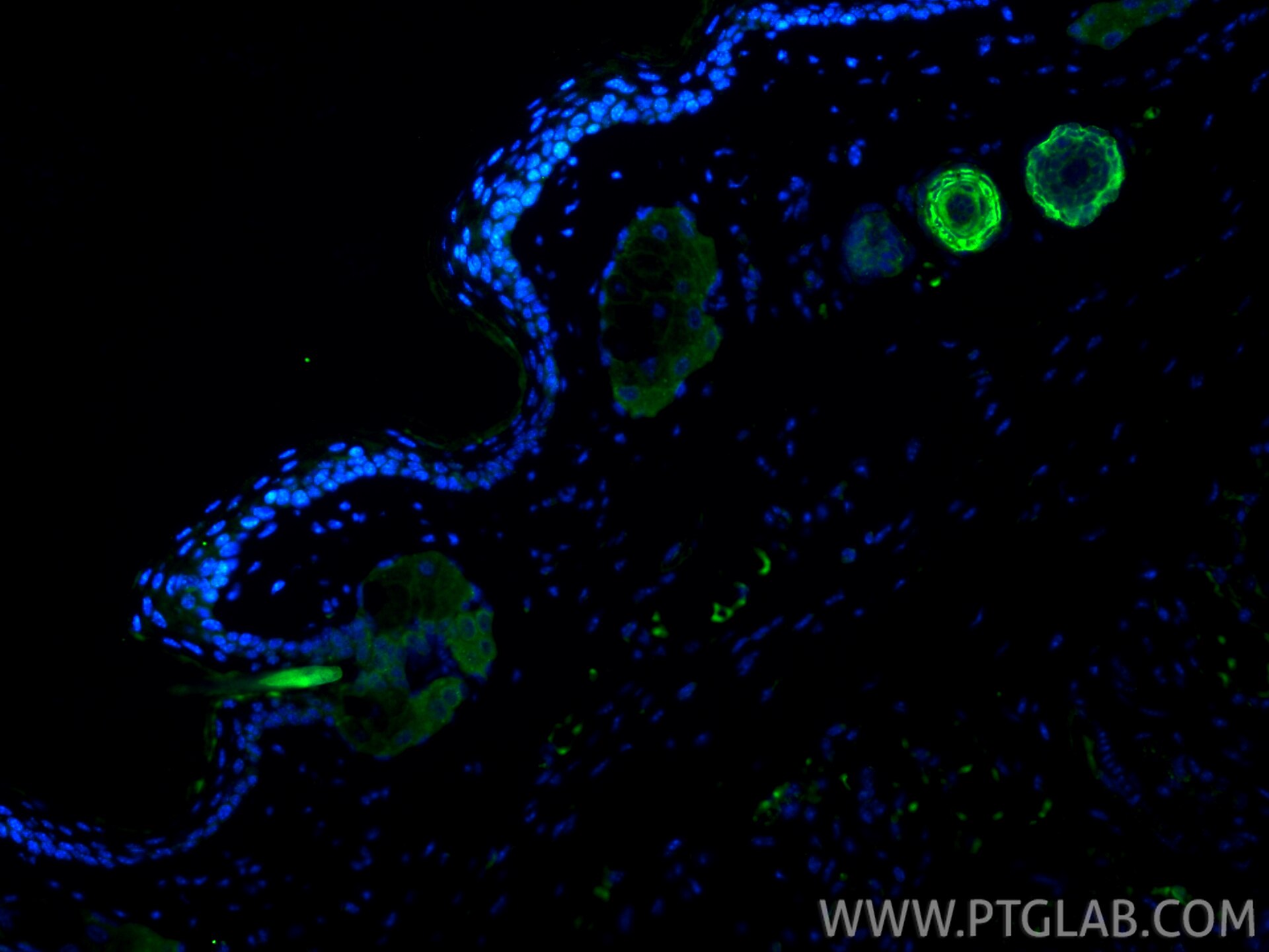 Immunofluorescence (IF) / fluorescent staining of mouse skin tissue using Cytokeratin 25 Recombinant monoclonal antibody (86465-1-RR)