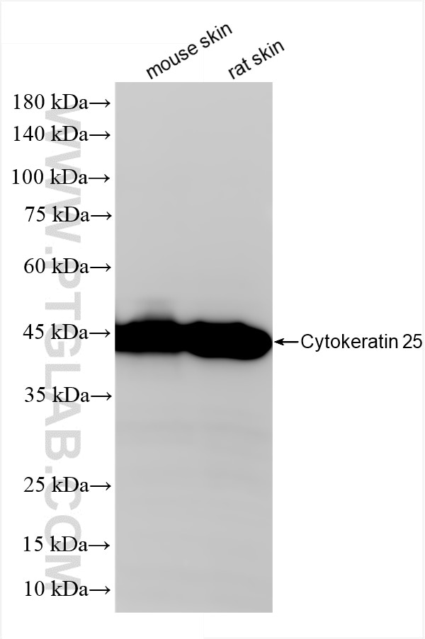 Western Blot (WB) analysis of various lysates using Cytokeratin 25 Recombinant antibody (86465-1-RR)