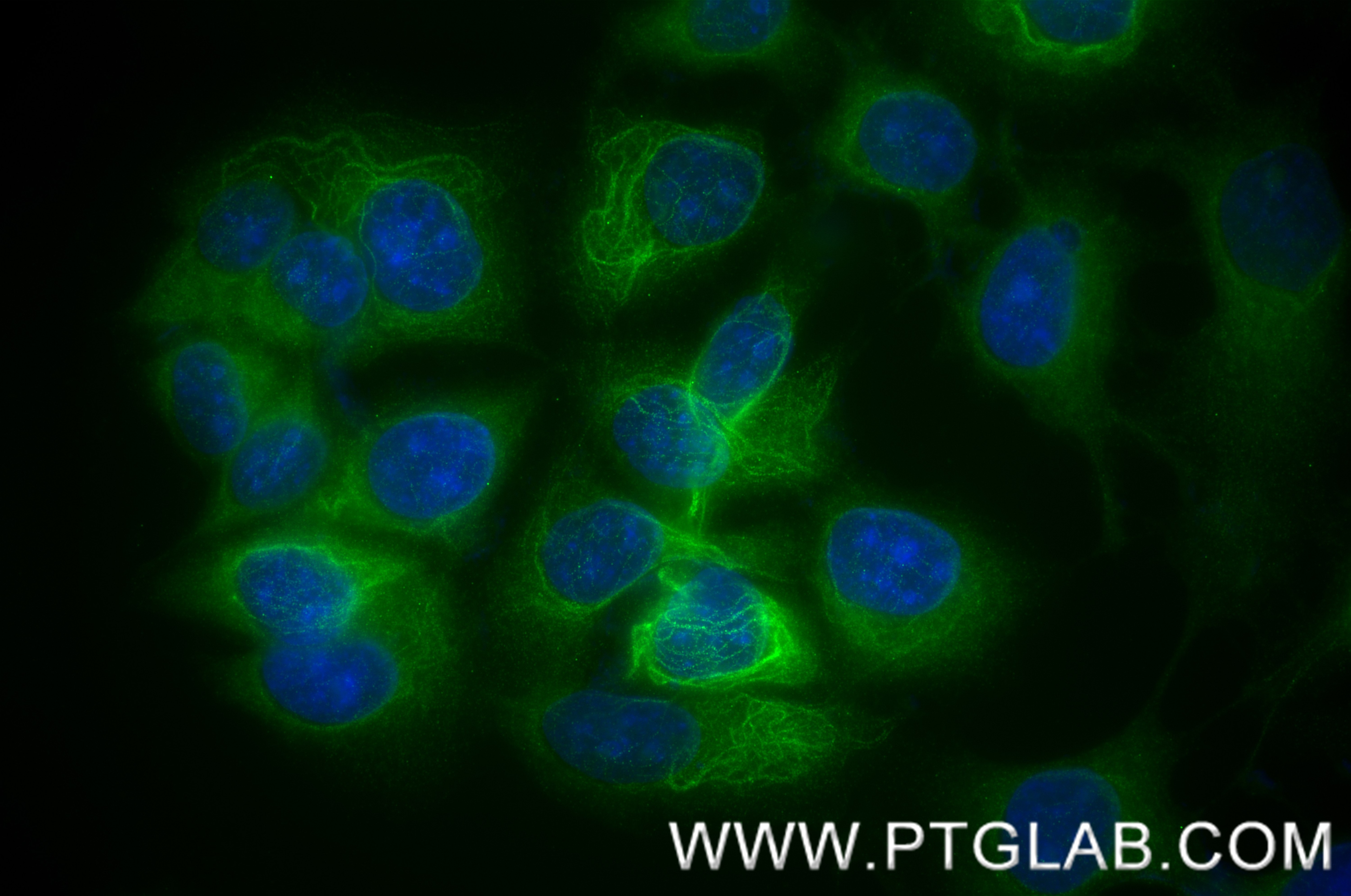 Immunofluorescence (IF) / fluorescent staining of MCF-7 cells using Cytokeratin 39 Recombinant monoclonal antibody (86277-2-RR)