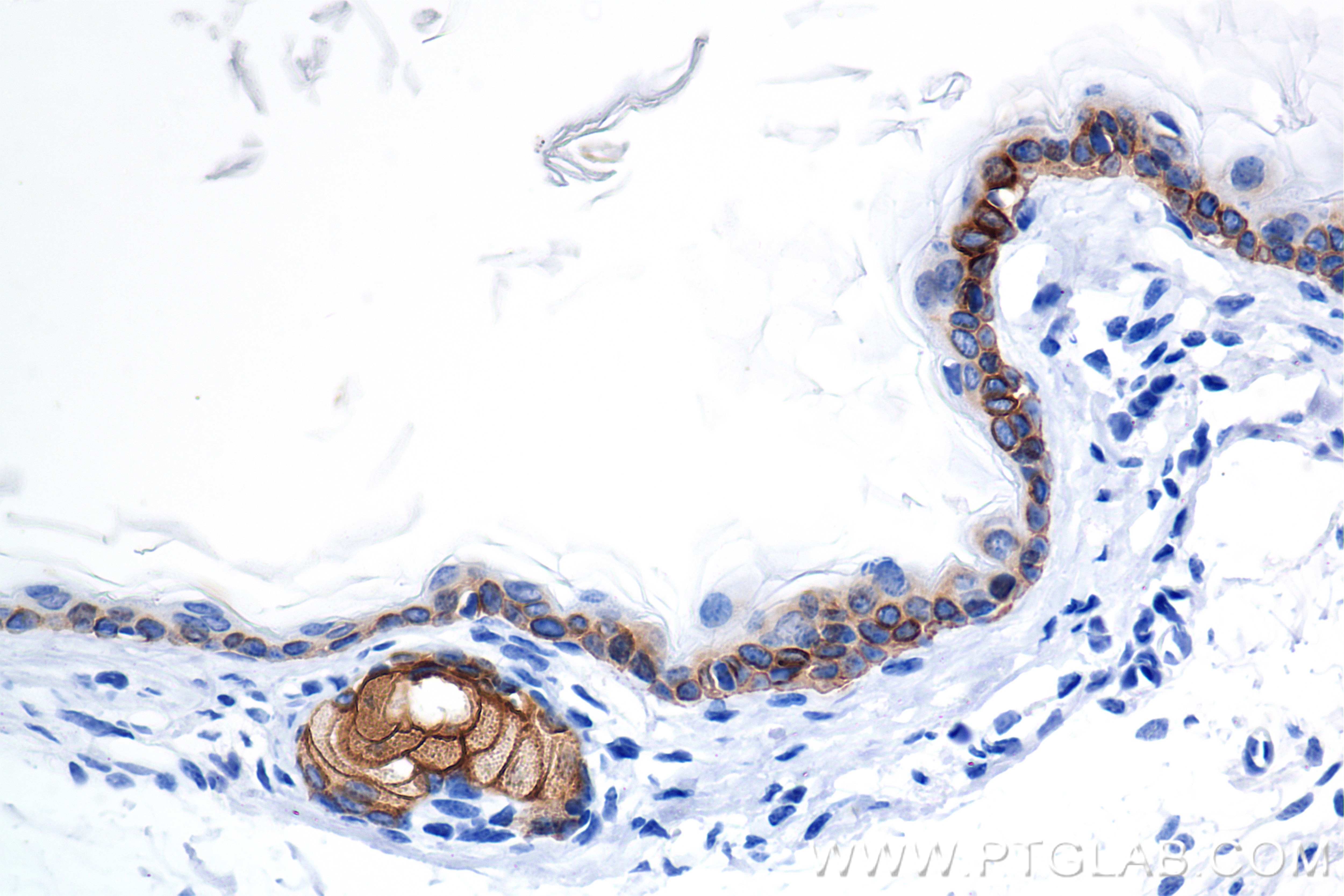 Immunohistochemistry (IHC) staining of mouse skin tissue using Cytokeratin 39 Recombinant antibody (86277-2-RR)