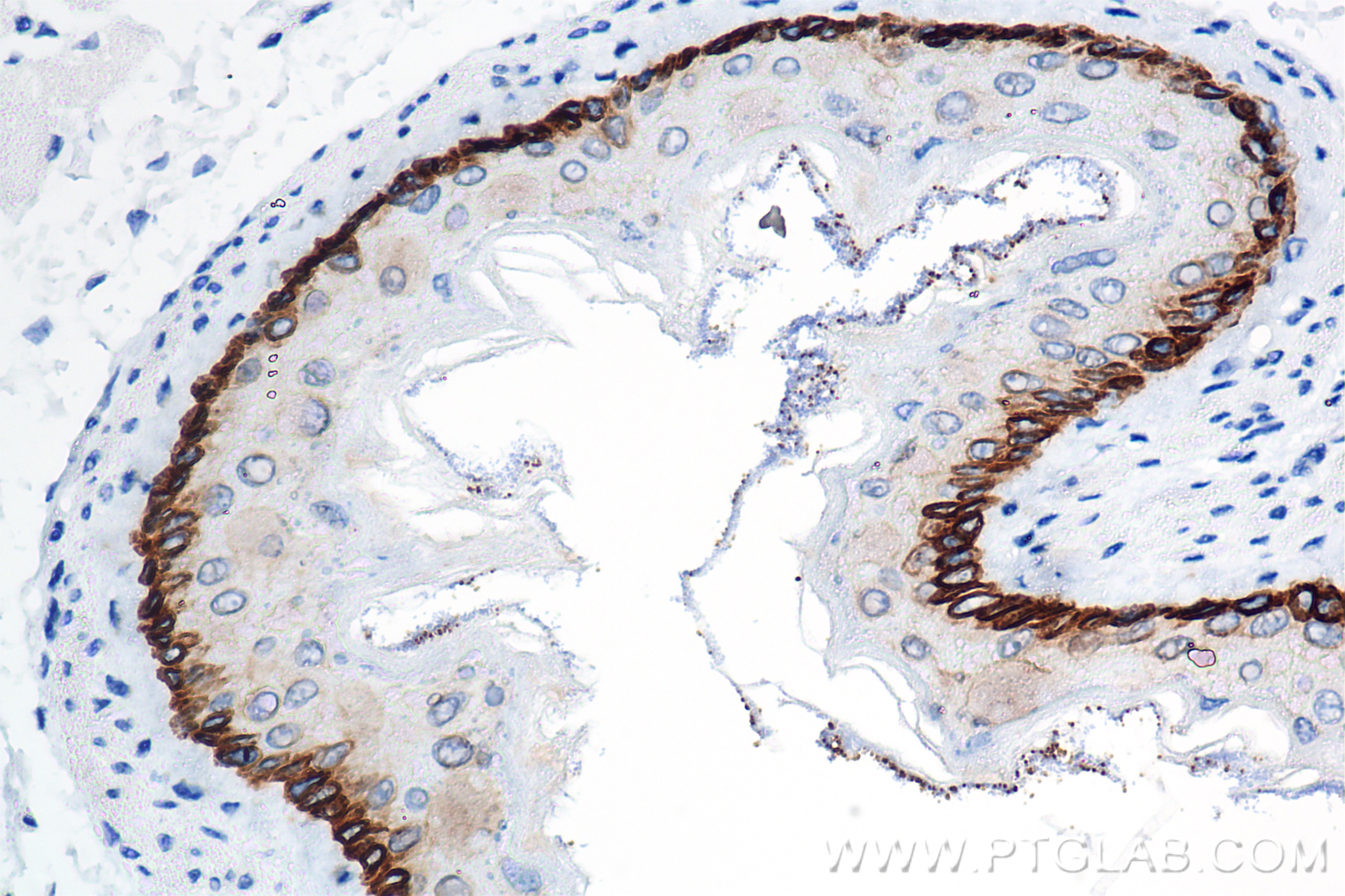 Immunohistochemistry (IHC) staining of mouse esophagus tissue using Cytokeratin 39 Recombinant antibody (86277-2-RR)