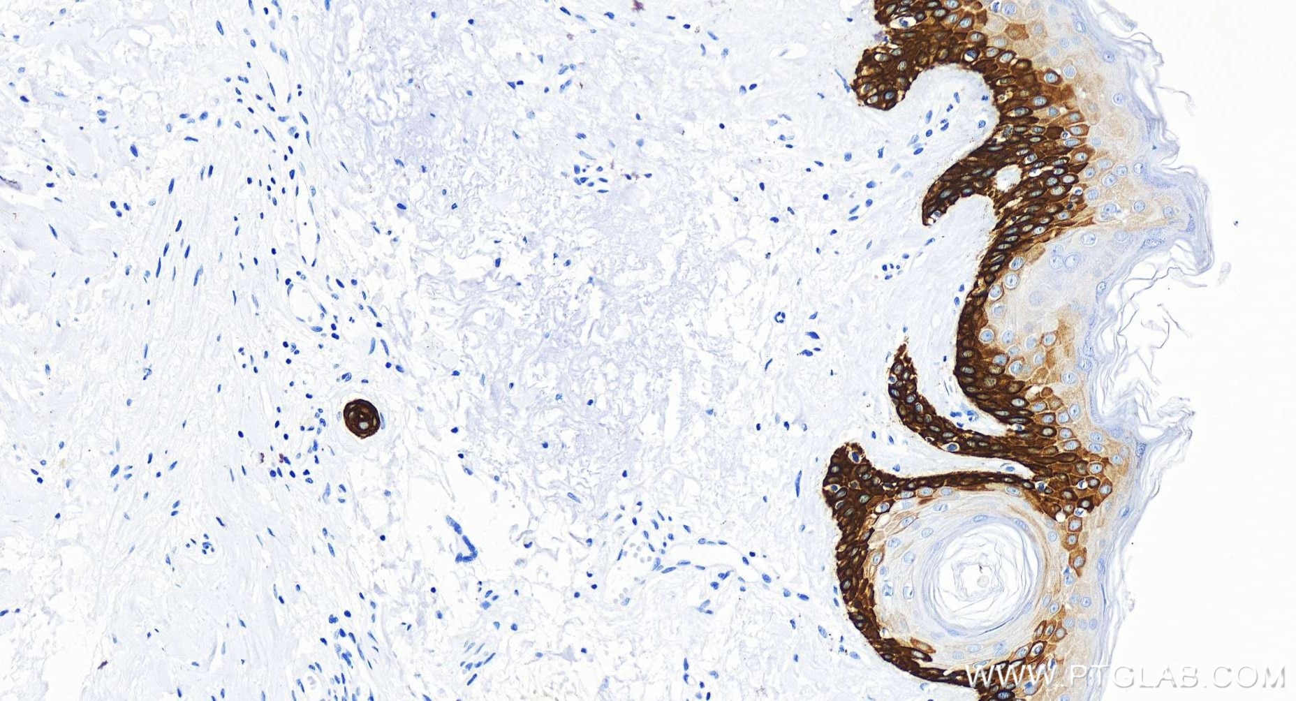 Immunohistochemistry (IHC) staining of human skin tissue using Cytokeratin 39 Recombinant antibody (86277-2-RR)