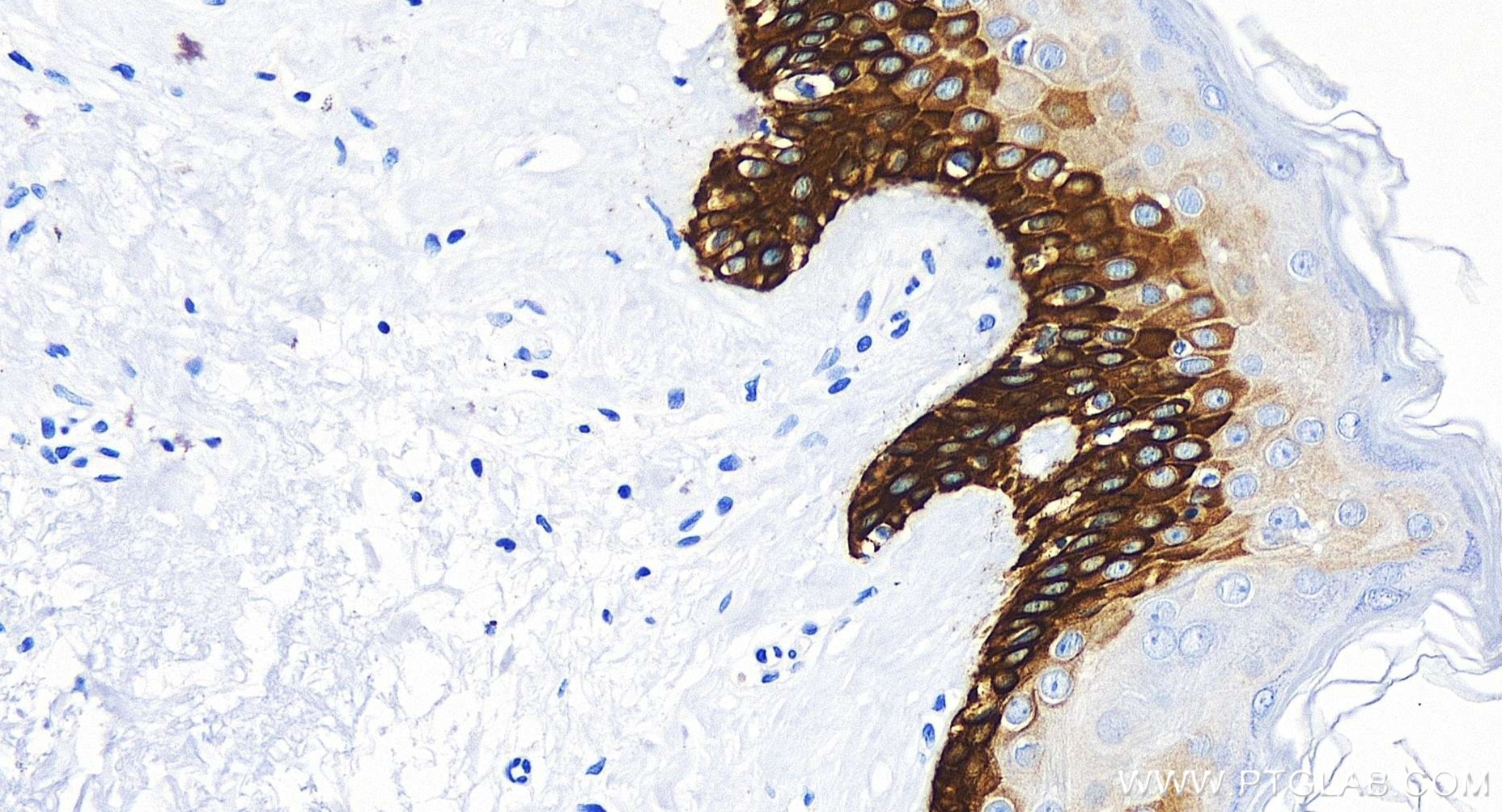 Immunohistochemistry (IHC) staining of human skin tissue using Cytokeratin 39 Recombinant antibody (86277-2-RR)