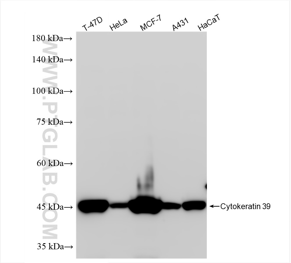 Western Blot (WB) analysis of various lysates using Cytokeratin 39 Recombinant antibody (86277-2-RR)