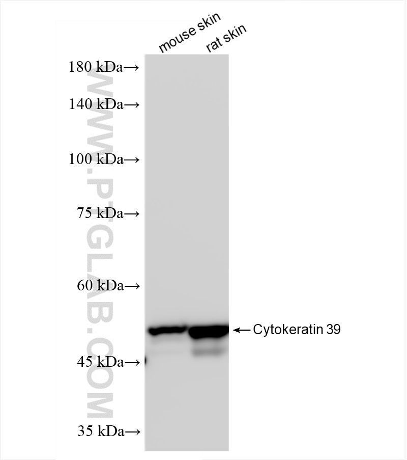 Western Blot (WB) analysis of various lysates using Cytokeratin 39 Recombinant antibody (86277-2-RR)