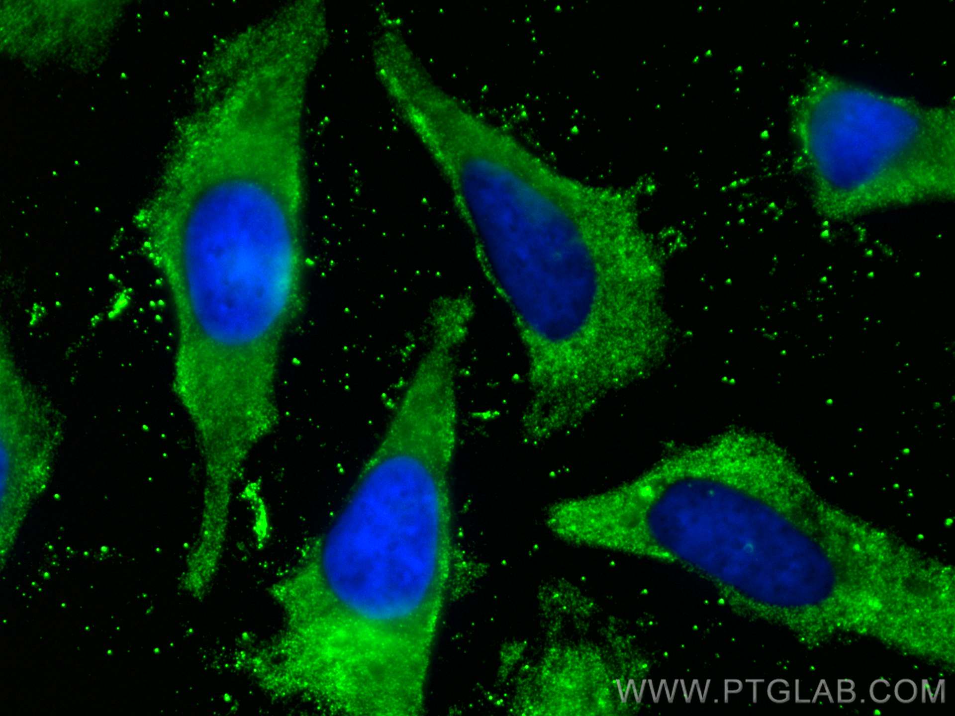 Immunofluorescence (IF) / fluorescent staining of HeLa cells using Cytokeratin 5/6 Monoclonal antibody (68295-1-Ig)