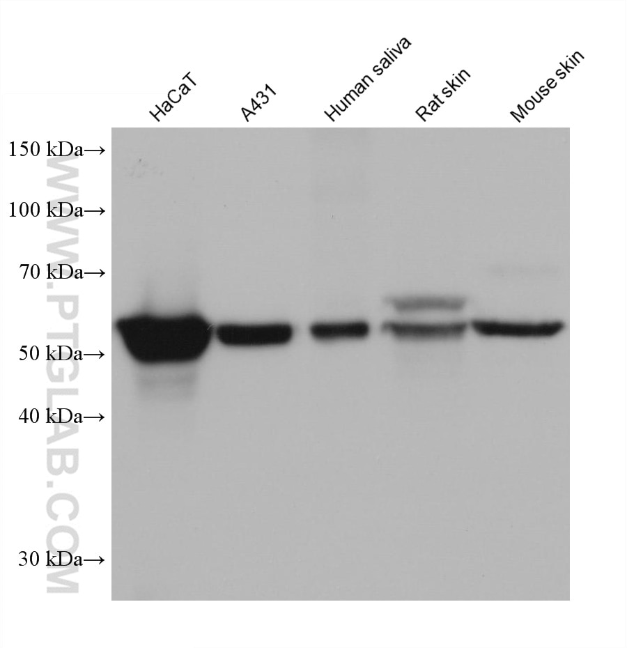 Western Blot (WB) analysis of various lysates using Cytokeratin 5/6 Monoclonal antibody (68295-1-Ig)