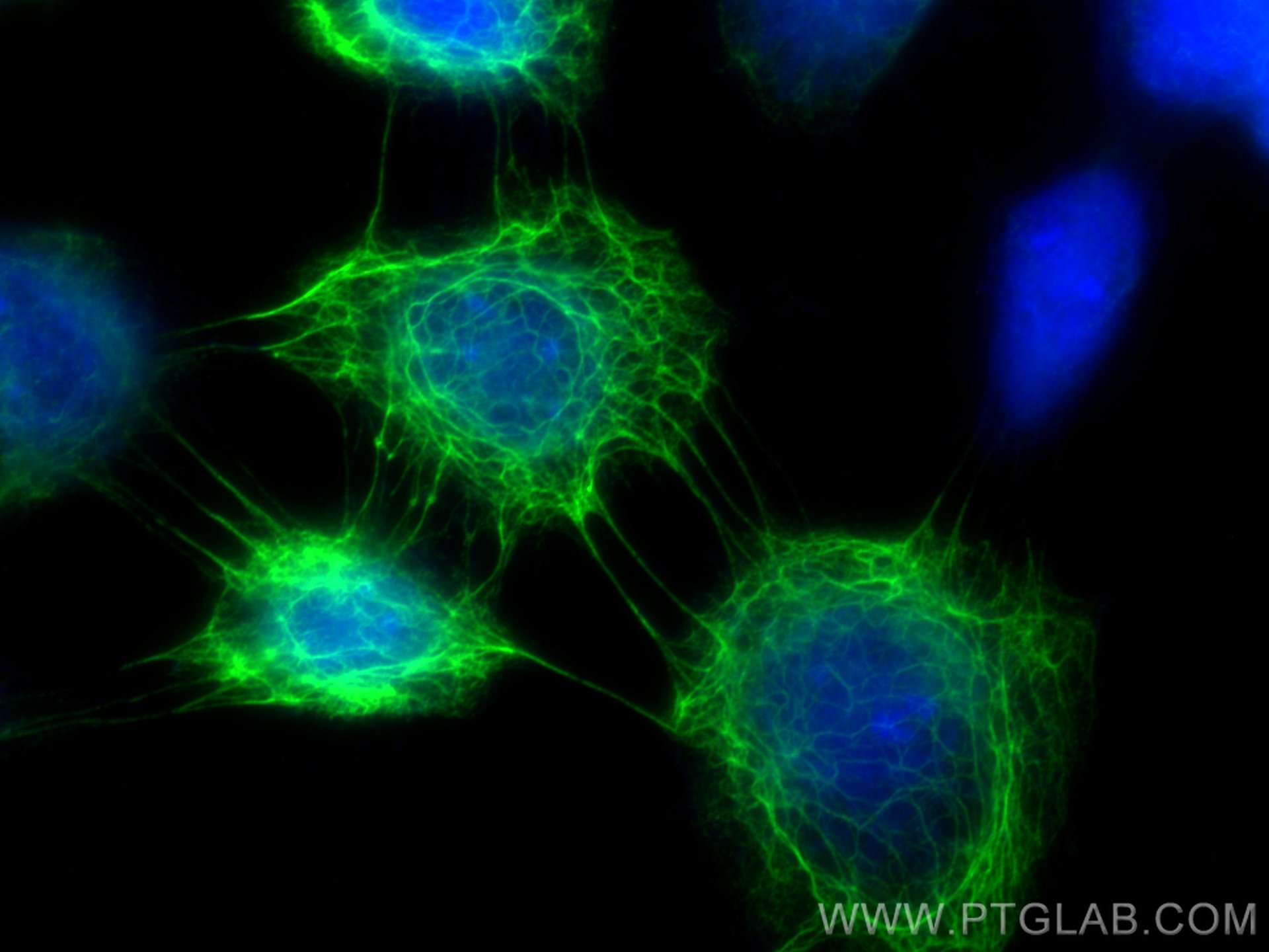 Immunofluorescence (IF) / fluorescent staining of A431 cells using Cytokeratin 5 Polyclonal antibody (28506-1-AP)