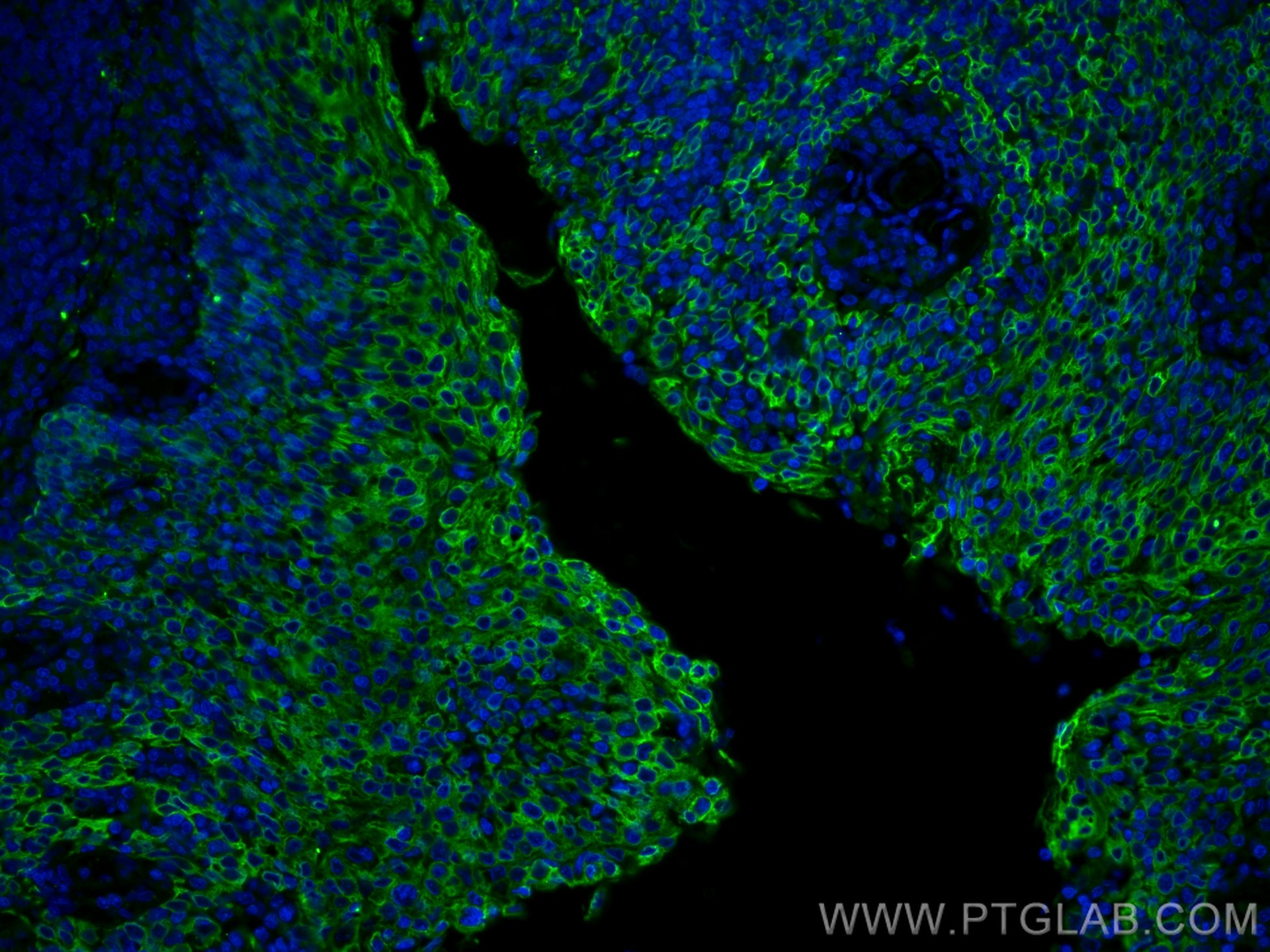 Immunofluorescence (IF) / fluorescent staining of human tonsillitis tissue using Cytokeratin 5 Polyclonal antibody (28506-1-AP)