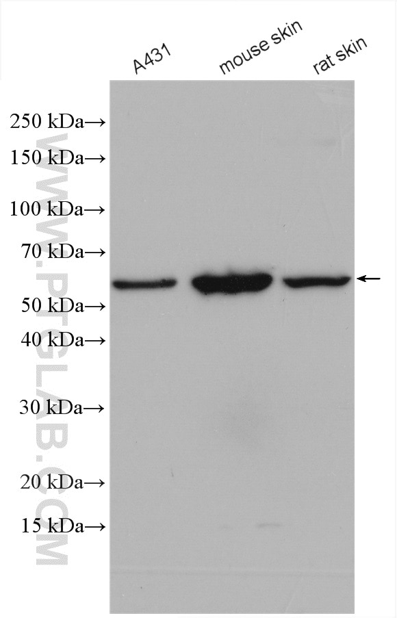 Western Blot (WB) analysis of various lysates using Cytokeratin 5 Polyclonal antibody (28506-1-AP)