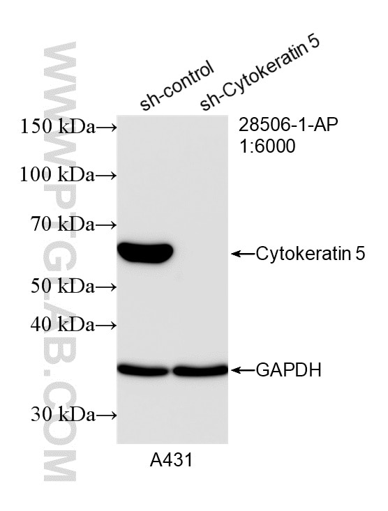 Western Blot (WB) analysis of A431 cells using Cytokeratin 5 Polyclonal antibody (28506-1-AP)