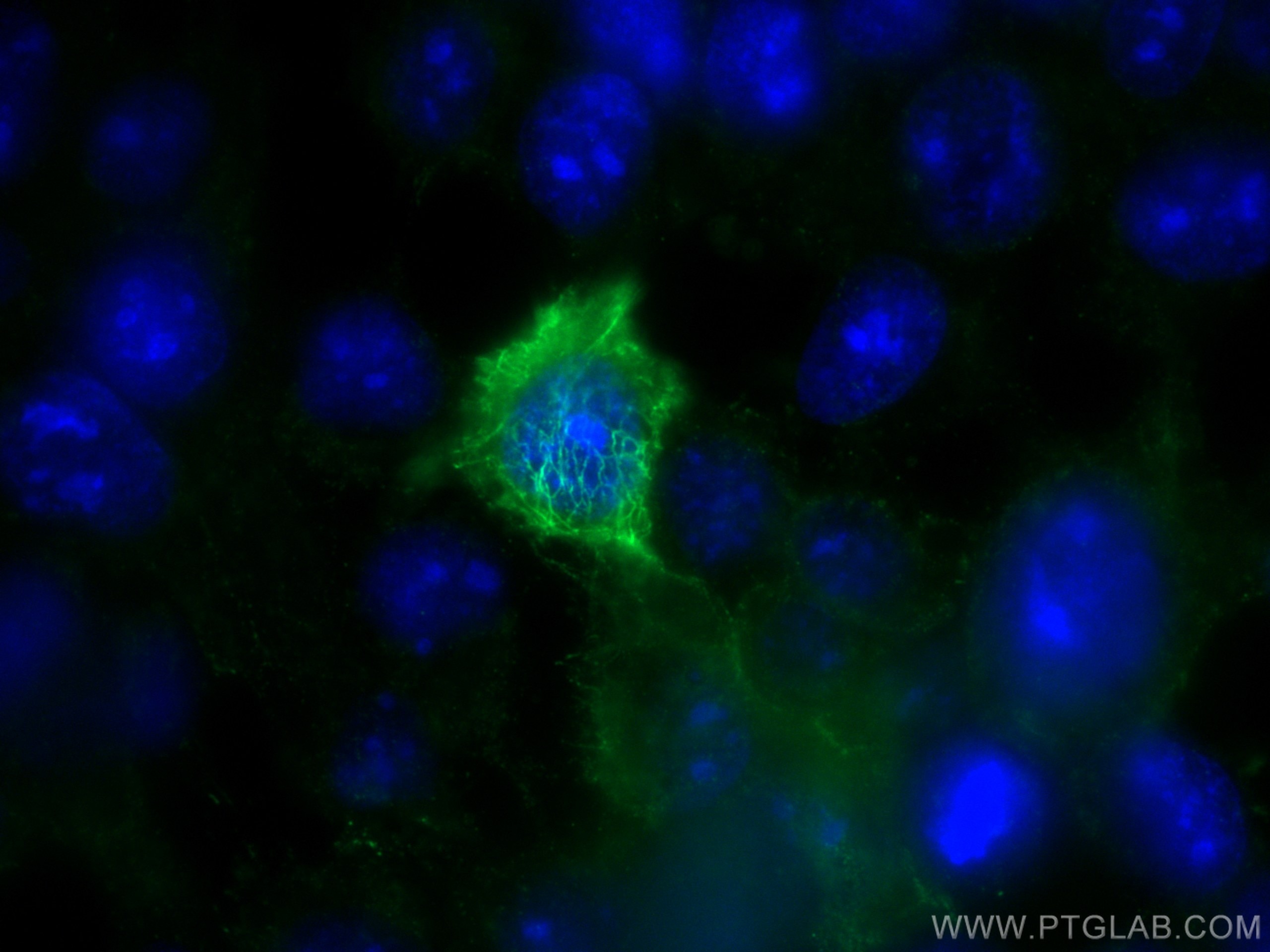 Immunofluorescence (IF) / fluorescent staining of A431 cells using Cytokeratin 5 Monoclonal antibody (66727-1-Ig)
