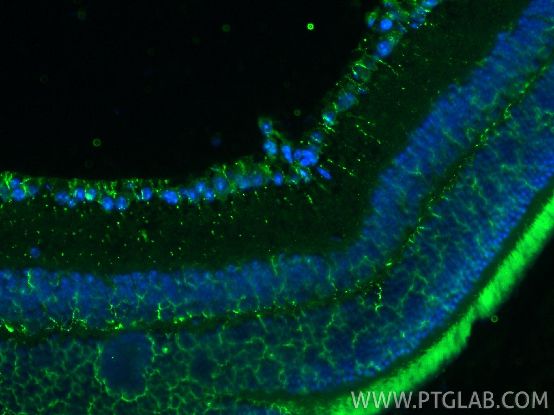 Immunofluorescence (IF) / fluorescent staining of mouse eye tissue using Cytokeratin 5 Monoclonal antibody (66727-1-Ig)