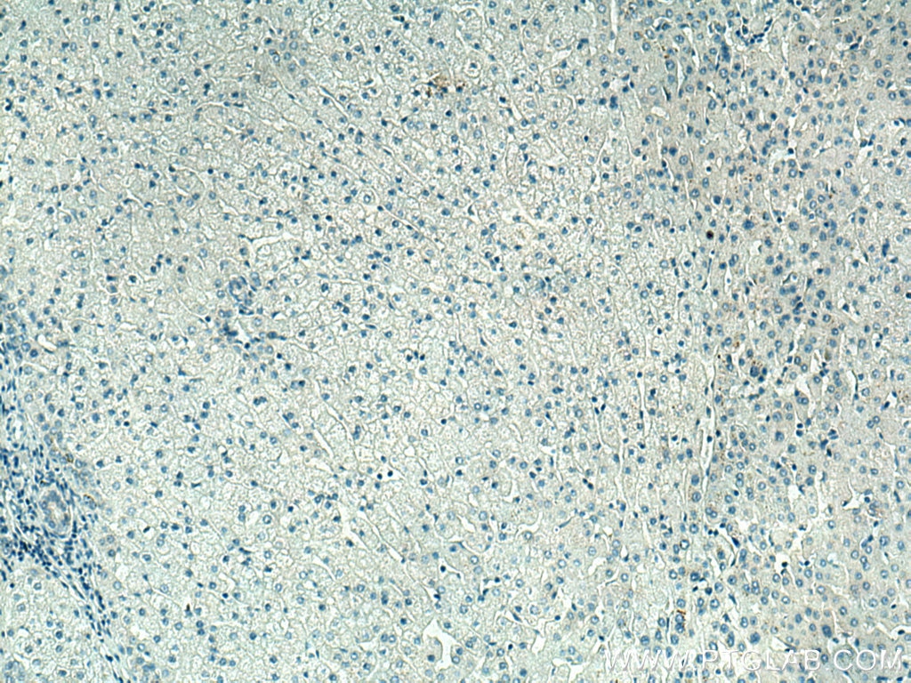 Immunohistochemistry (IHC) staining of human liver tissue using Cytokeratin 5 Monoclonal antibody (66727-1-Ig)