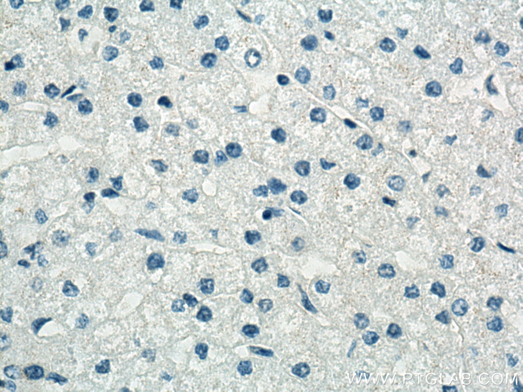 IHC staining of human liver using 66727-1-Ig