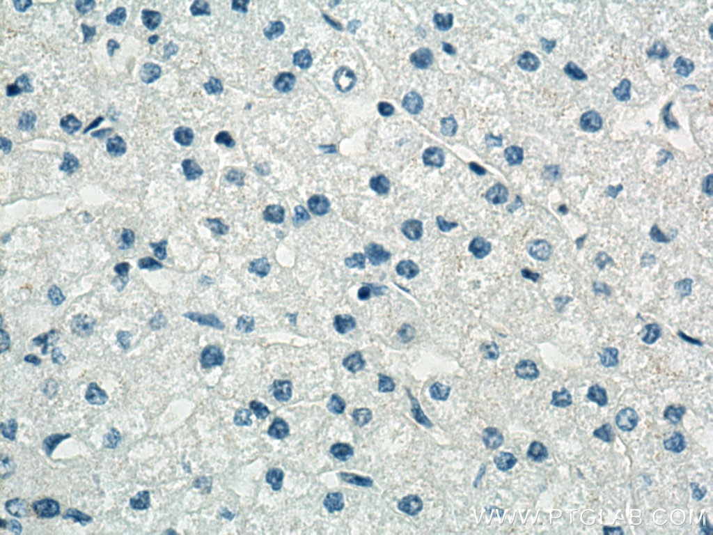 Immunohistochemistry (IHC) staining of human liver tissue using Cytokeratin 5 Monoclonal antibody (66727-1-Ig)