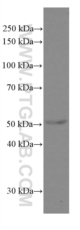 Western Blot (WB) analysis of MCF-7 cells using Cytokeratin 5 Monoclonal antibody (66727-1-Ig)