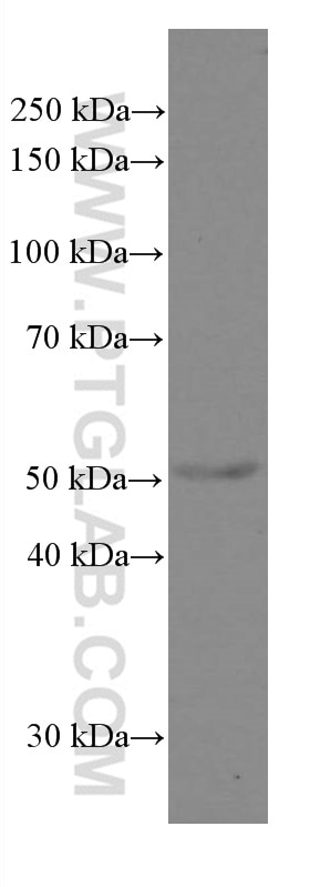 WB analysis of MCF-7 using 66727-1-Ig