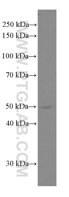 Western Blot (WB) analysis of A549 cells using Cytokeratin 5 Monoclonal antibody (66727-1-Ig)