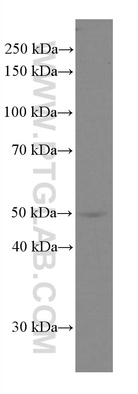 WB analysis of A549 using 66727-1-Ig