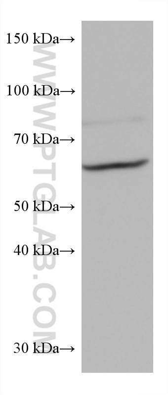Western Blot (WB) analysis of mouse skin tissue using Cytokeratin 5 Monoclonal antibody (66727-1-Ig)