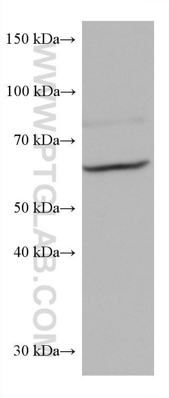 WB analysis of mouse skin using 66727-1-Ig