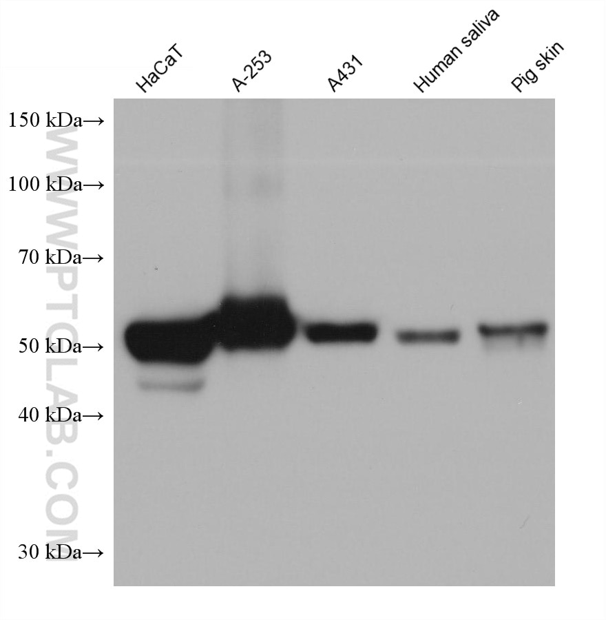 Western Blot (WB) analysis of various lysates using Cytokeratin 5 Monoclonal antibody (66727-1-Ig)