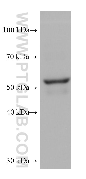 Western Blot (WB) analysis of mouse skin tissue using Cytokeratin 5 Monoclonal antibody (66727-1-Ig)