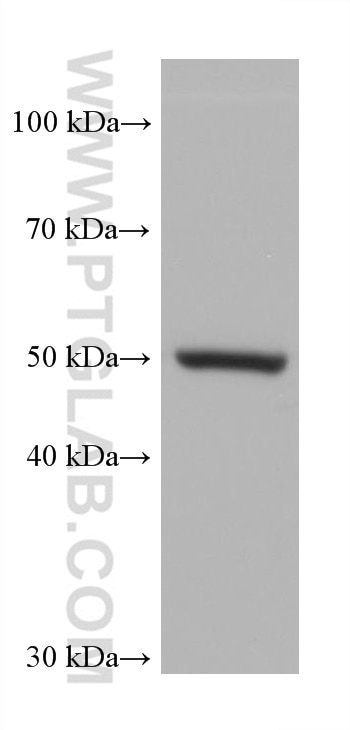 Western Blot (WB) analysis of SKOV-3 cells using Cytokeratin 5 Monoclonal antibody (66727-1-Ig)