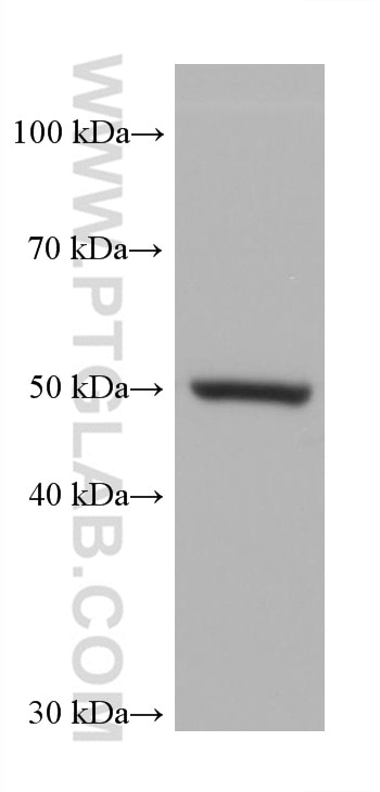 WB analysis of SKOV-3 using 66727-1-Ig