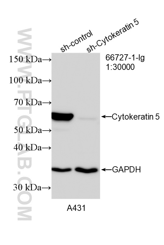 Western Blot (WB) analysis of A431 cells using Cytokeratin 5 Monoclonal antibody (66727-1-Ig)