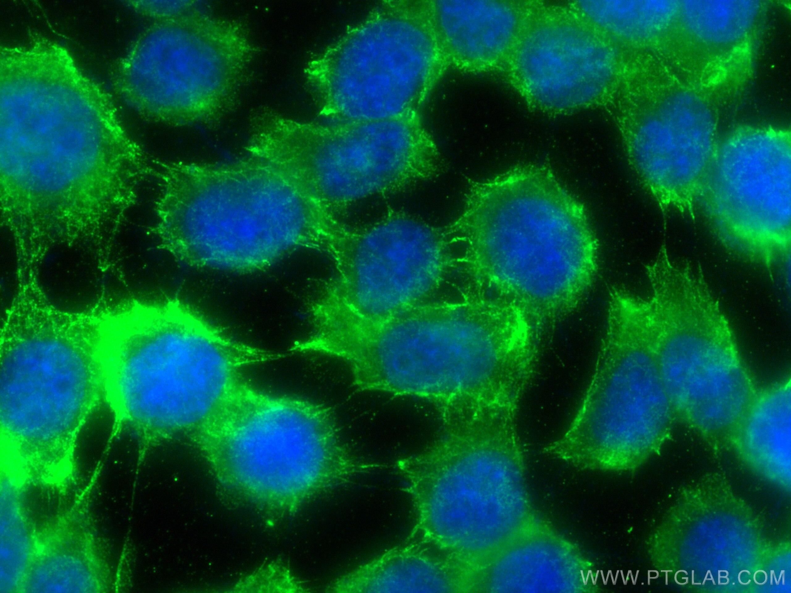 Immunofluorescence (IF) / fluorescent staining of A431 cells using Cytokeratin 5 Recombinant antibody (82548-7-RR)