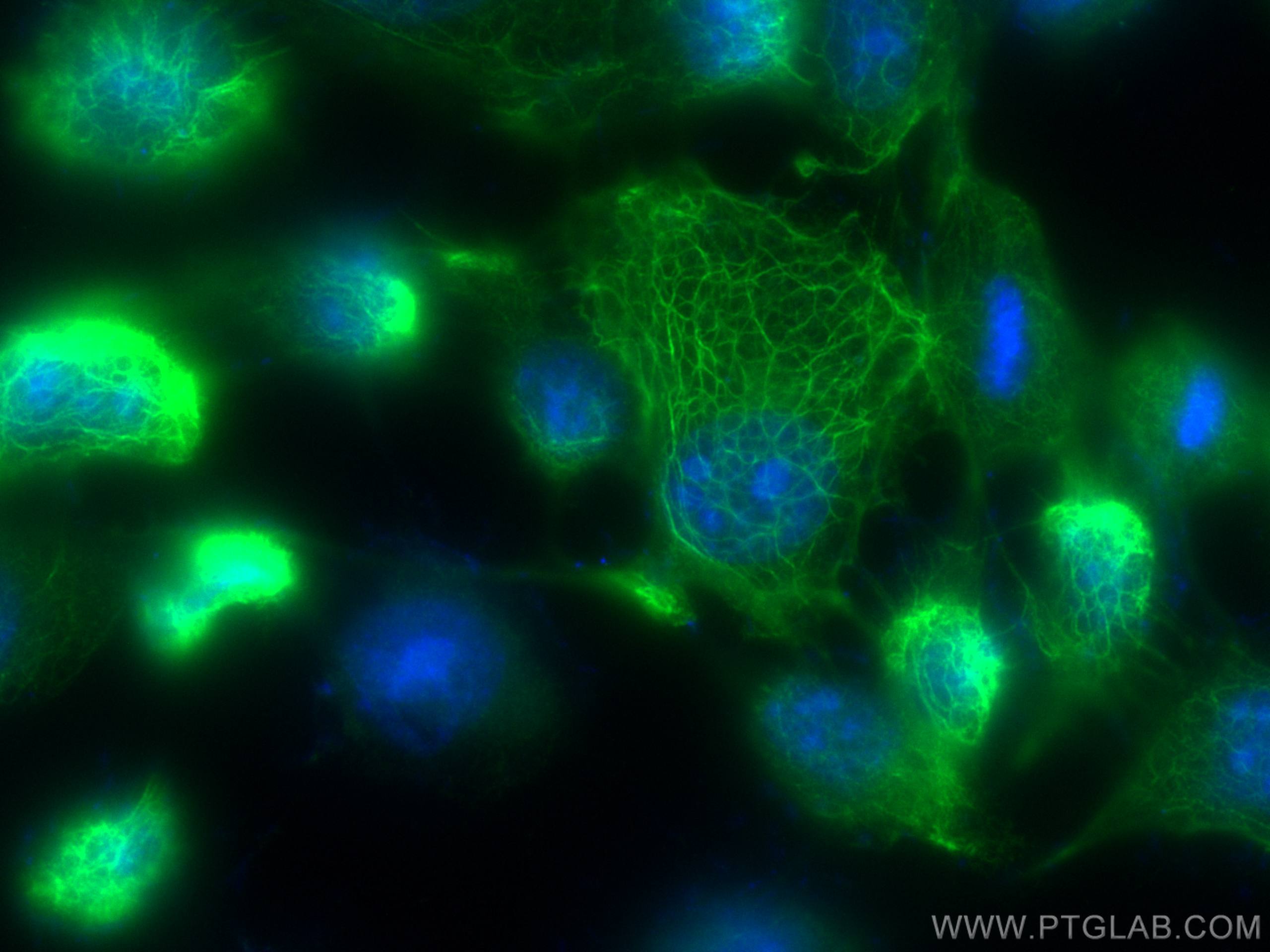 Immunofluorescence (IF) / fluorescent staining of A431 cells using CoraLite® Plus 488-conjugated Cytokeratin 5 Polycl (CL488-28506)