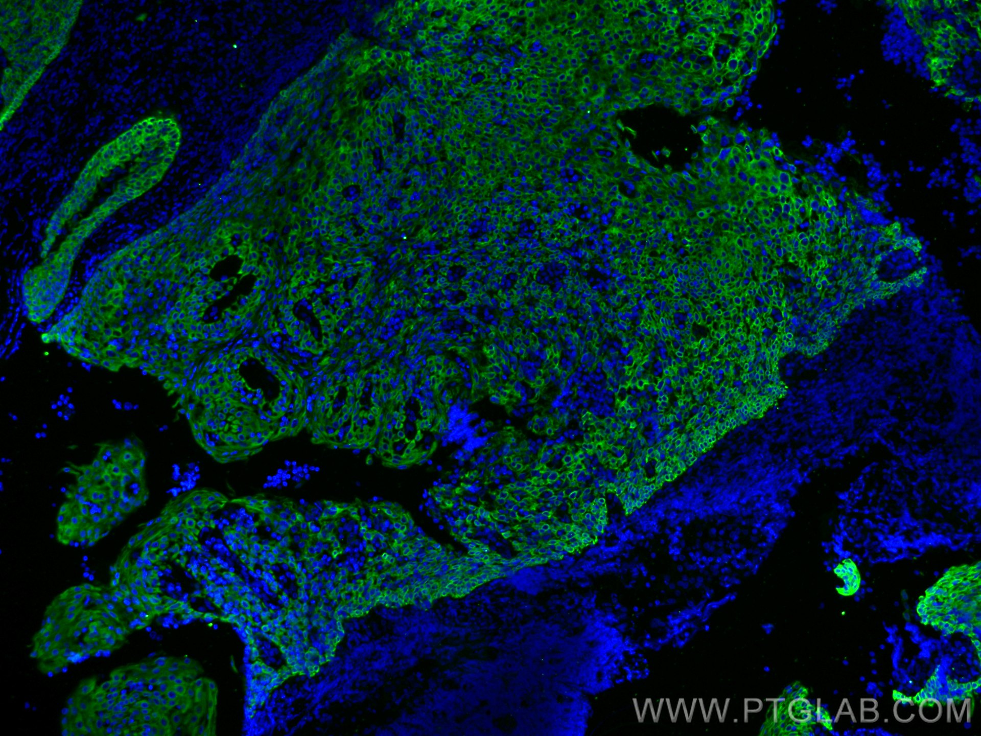 Immunofluorescence (IF) / fluorescent staining of human tonsillitis tissue using CoraLite® Plus 488-conjugated Cytokeratin 5 Polycl (CL488-28506)