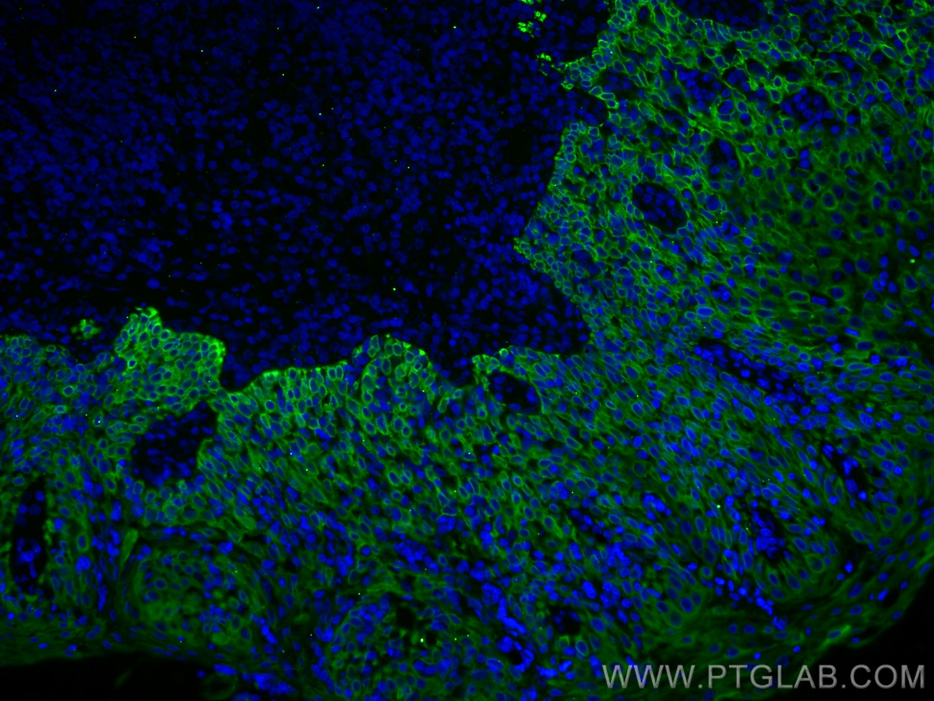 Immunofluorescence (IF) / fluorescent staining of human tonsillitis tissue using CoraLite® Plus 488-conjugated Cytokeratin 5 Polycl (CL488-28506)