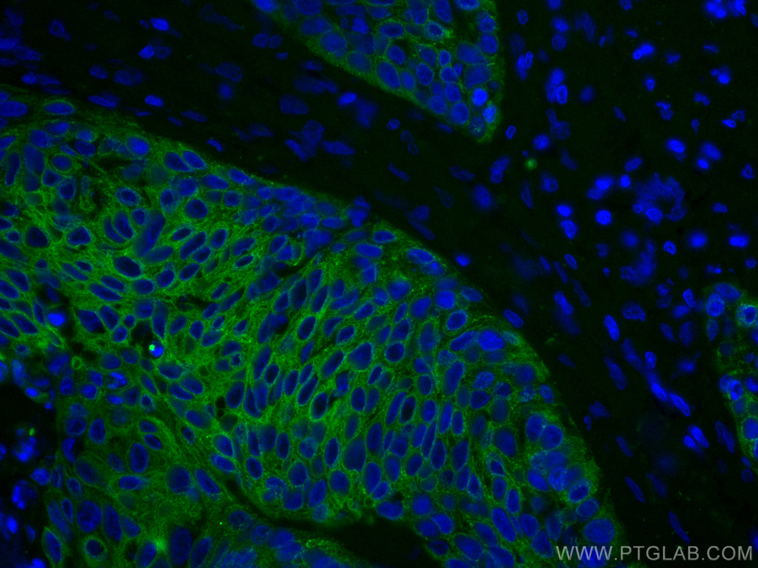 Cytokeratin 5