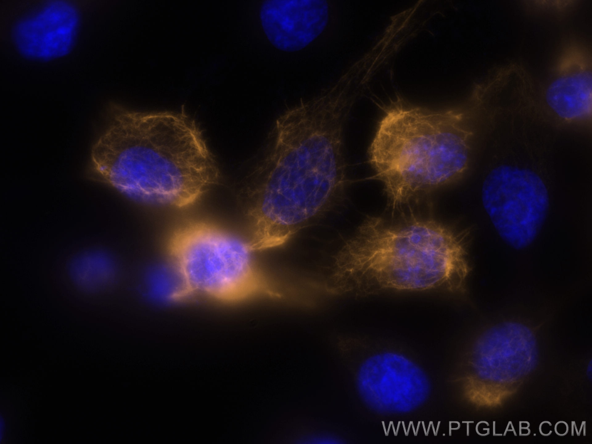 Immunofluorescence (IF) / fluorescent staining of A431 cells using CoraLite®555-conjugated Cytokeratin 5 Polyclonal a (CL555-28506)