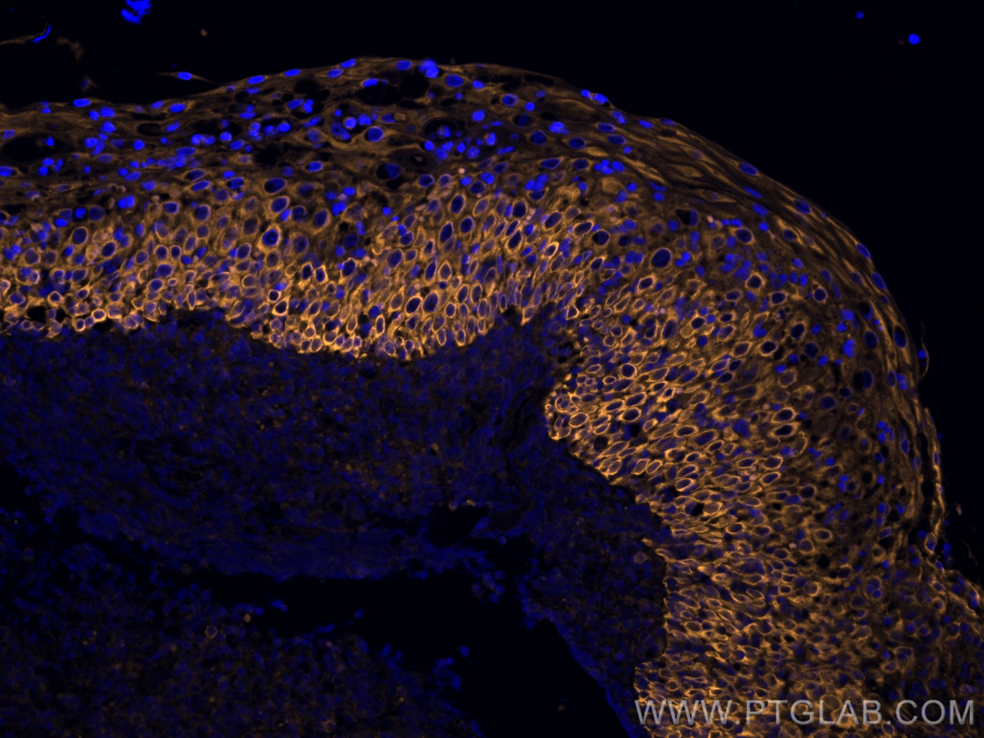 Immunofluorescence (IF) / fluorescent staining of human tonsillitis tissue using CoraLite®555-conjugated Cytokeratin 5 Polyclonal a (CL555-28506)