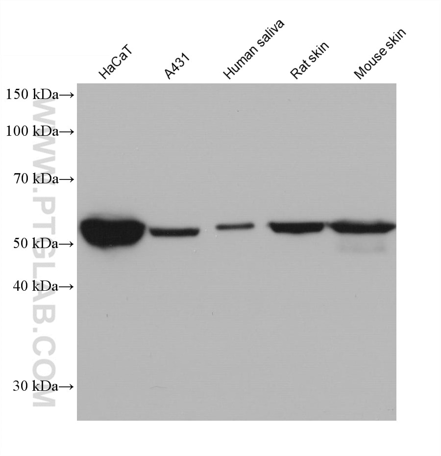 Western Blot (WB) analysis of various lysates using Cytokeratin 6 Monoclonal antibody (68294-1-Ig)