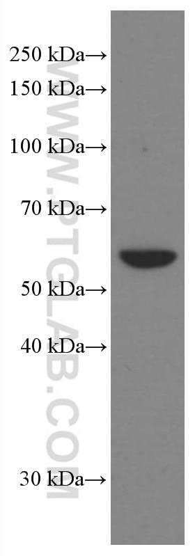 Western Blot (WB) analysis of A431 cells using Cytokeratin 6A Monoclonal antibody (66685-1-Ig)