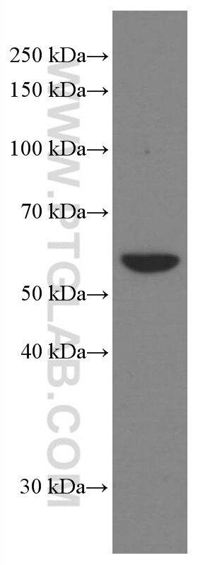 WB analysis of A431 using 66685-1-Ig