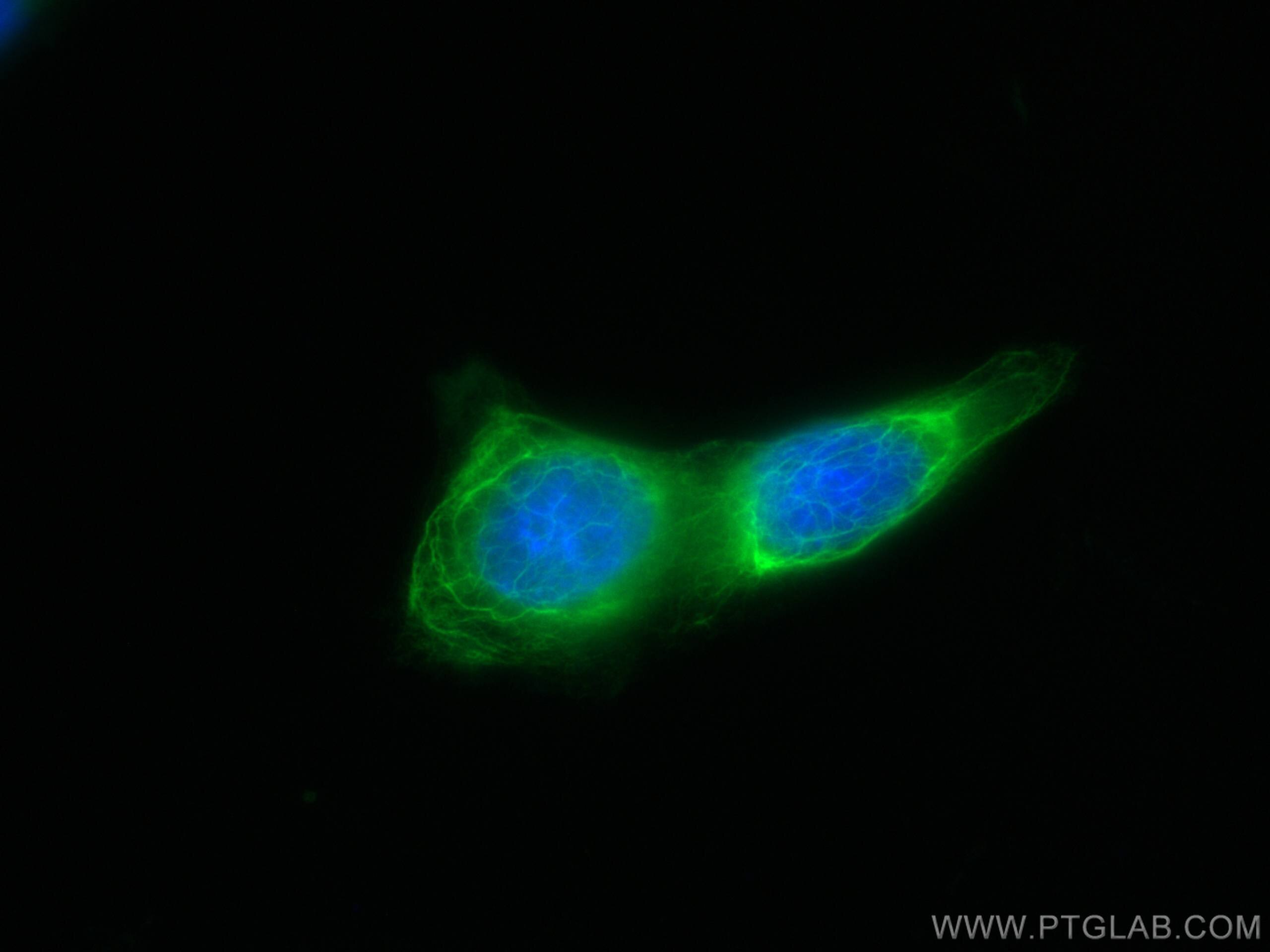 Immunofluorescence (IF) / fluorescent staining of A431 cells using CoraLite® Plus 488-conjugated Cytokeratin 6A Polyc (CL488-10590)