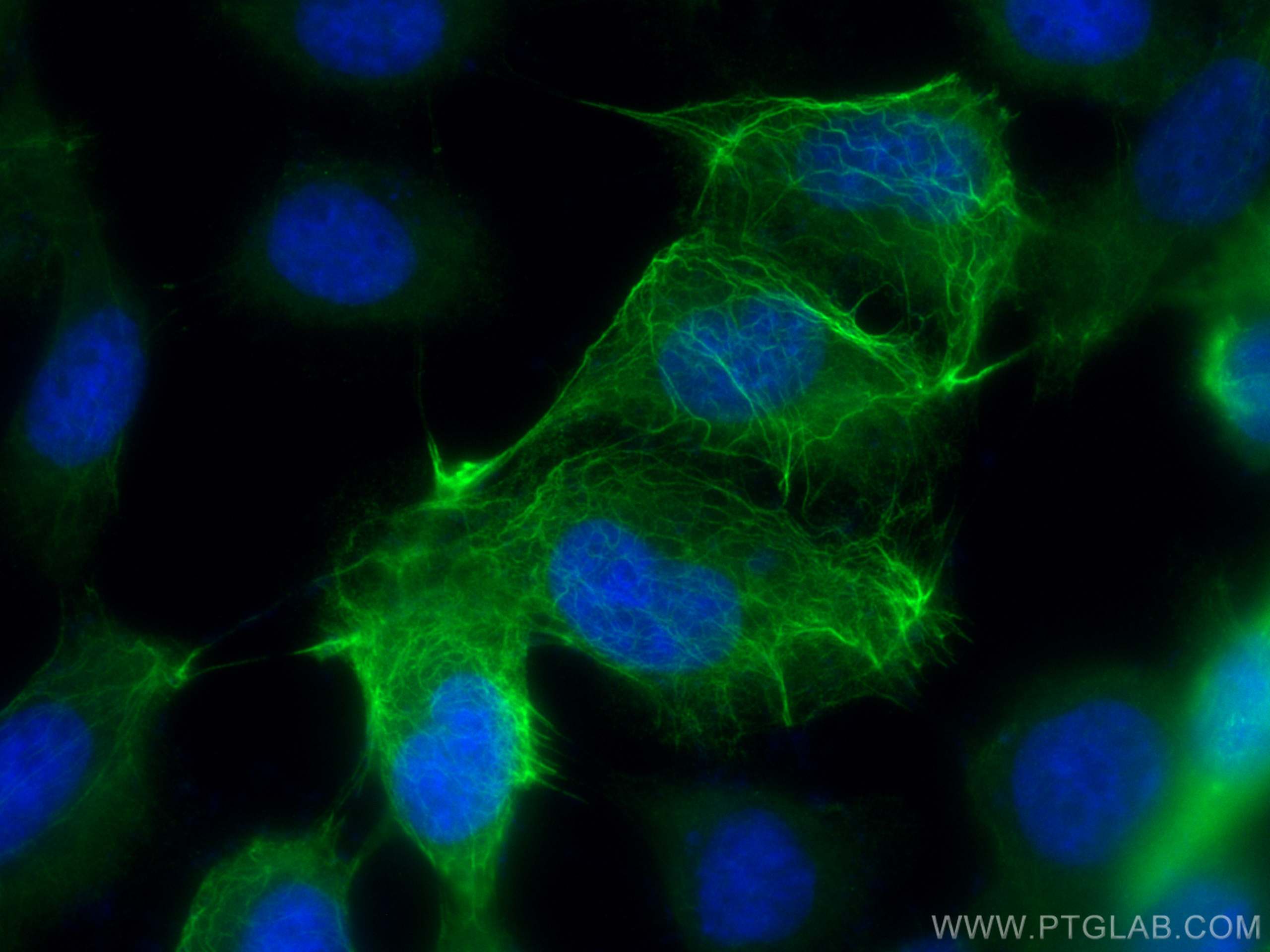 Immunofluorescence (IF) / fluorescent staining of A431 cells using CoraLite® Plus 488-conjugated Cytokeratin 6A Polyc (CL488-10590)