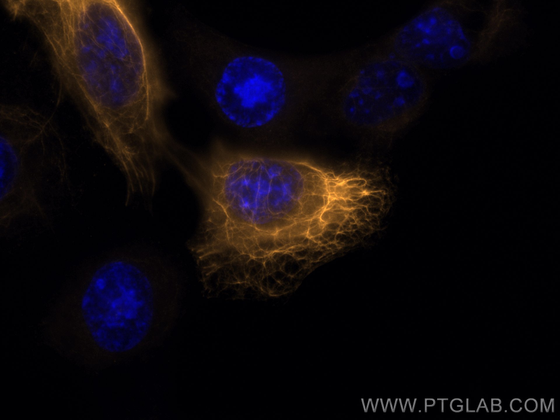Immunofluorescence (IF) / fluorescent staining of A431 cells using CoraLite®555-conjugated Cytokeratin 6A Polyclonal  (CL555-10590)